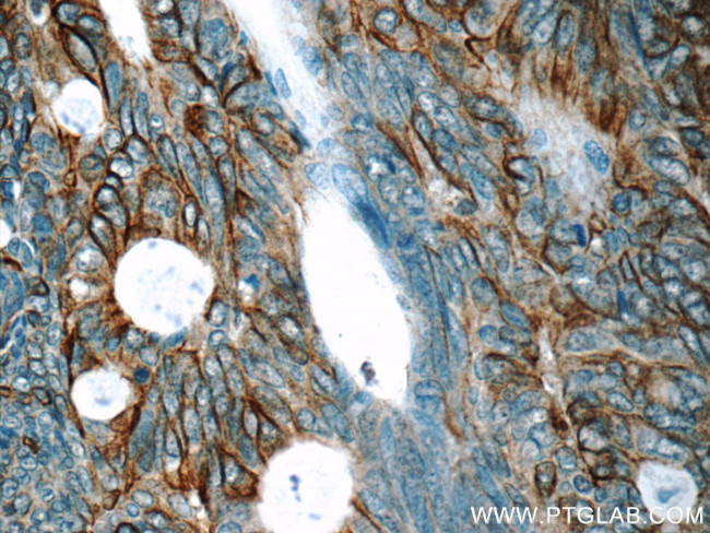 Claudin 23 Antibody in Immunohistochemistry (Paraffin) (IHC (P))