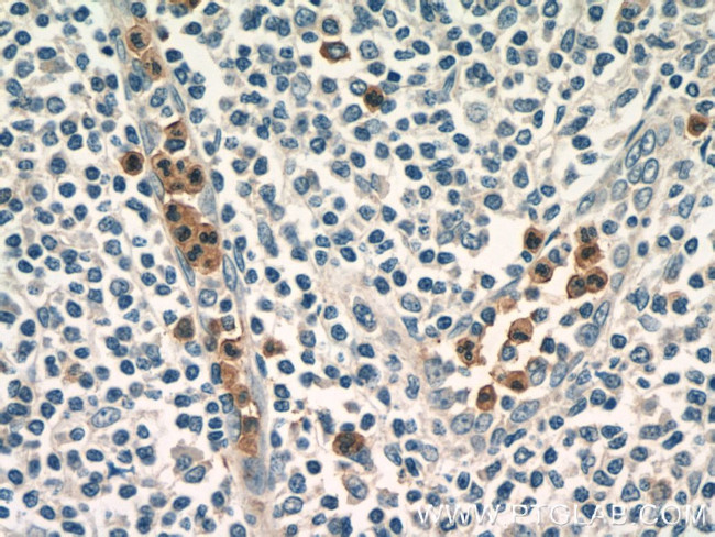 ASB14 Antibody in Immunohistochemistry (Paraffin) (IHC (P))