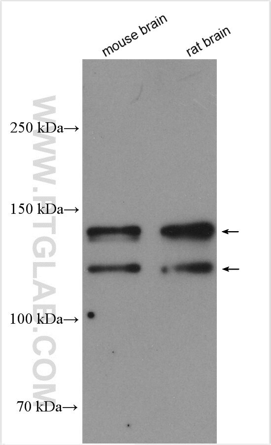 TMEM132A Antibody in Western Blot (WB)
