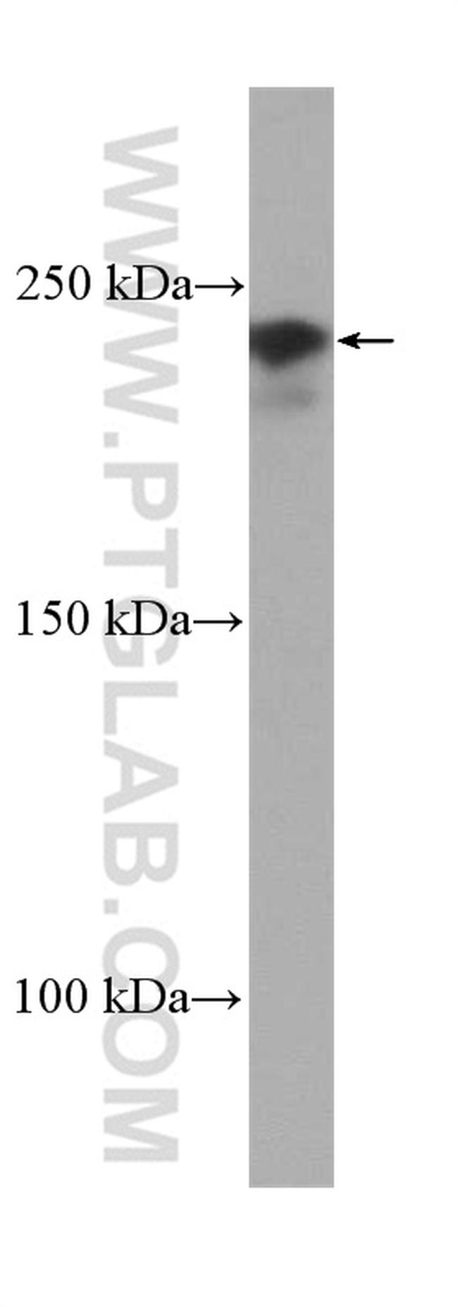 TRIP12 Antibody in Western Blot (WB)