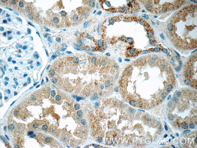 DTX3 Antibody in Immunohistochemistry (Paraffin) (IHC (P))