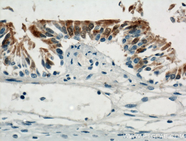 PIH1D3 Antibody in Immunohistochemistry (Paraffin) (IHC (P))