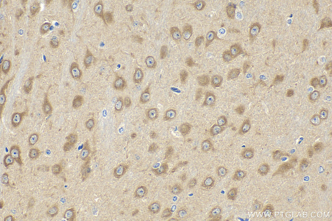 CAMK2N1 Antibody in Immunohistochemistry (Paraffin) (IHC (P))