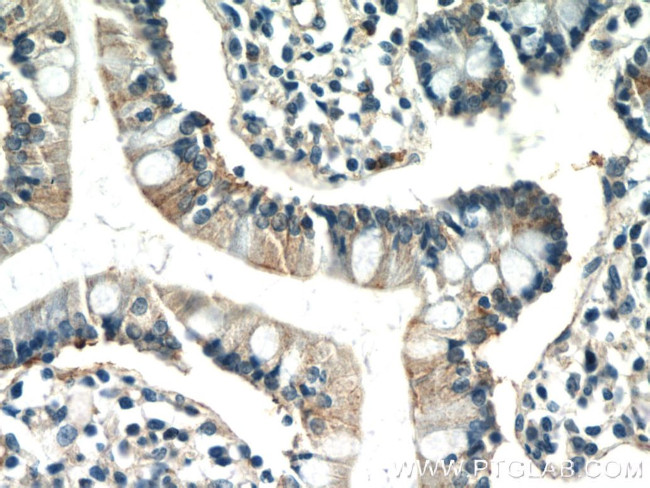 IQSEC2 Antibody in Immunohistochemistry (Paraffin) (IHC (P))