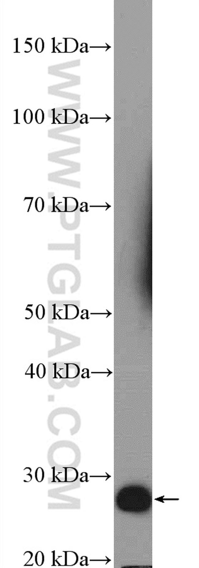 RSPO1 Antibody in Western Blot (WB)