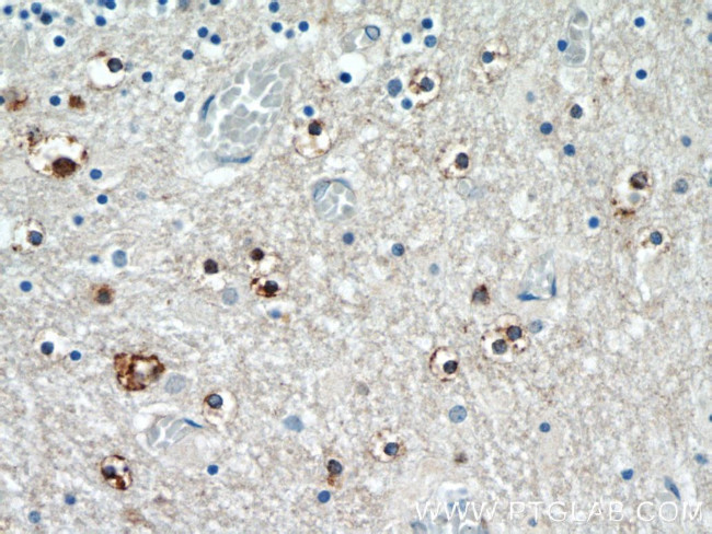 TNRC4 Antibody in Immunohistochemistry (Paraffin) (IHC (P))