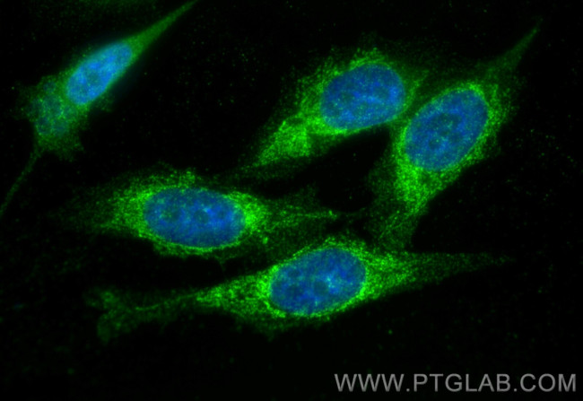 ABHD11 Antibody in Immunocytochemistry (ICC/IF)