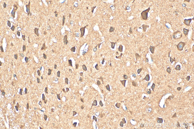 ACCN5 Antibody in Immunohistochemistry (Paraffin) (IHC (P))