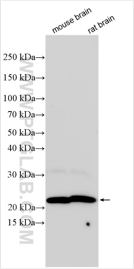 PPP1R16B Antibody in Western Blot (WB)
