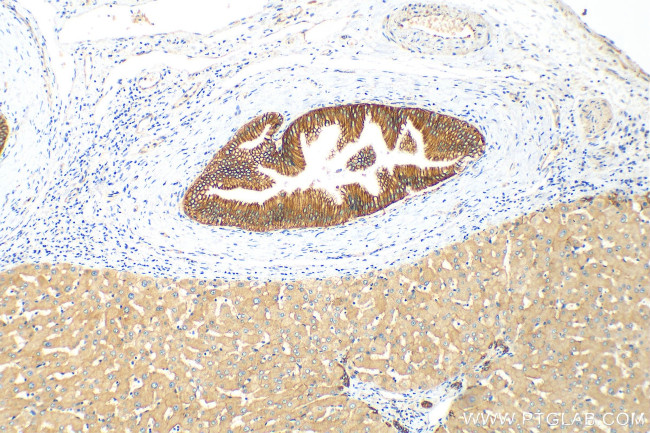 MRP3/ABCC3 Antibody in Immunohistochemistry (Paraffin) (IHC (P))
