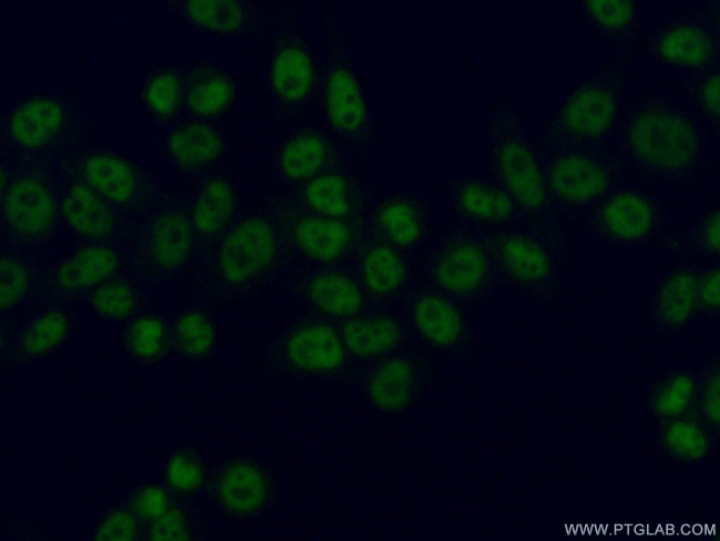 SBNO1 Antibody in Immunocytochemistry (ICC/IF)