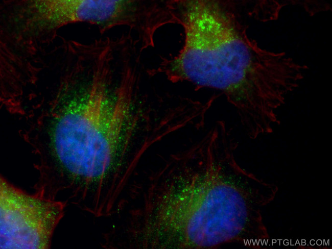 ZFYVE28 Antibody in Immunocytochemistry (ICC/IF)