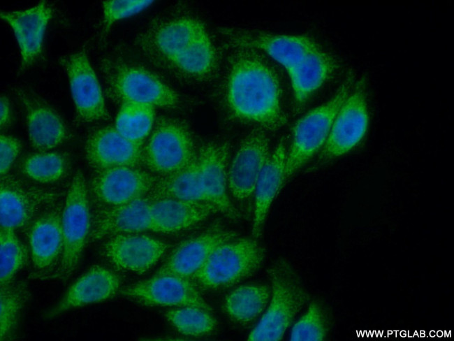 C1orf163 Antibody in Immunocytochemistry (ICC/IF)