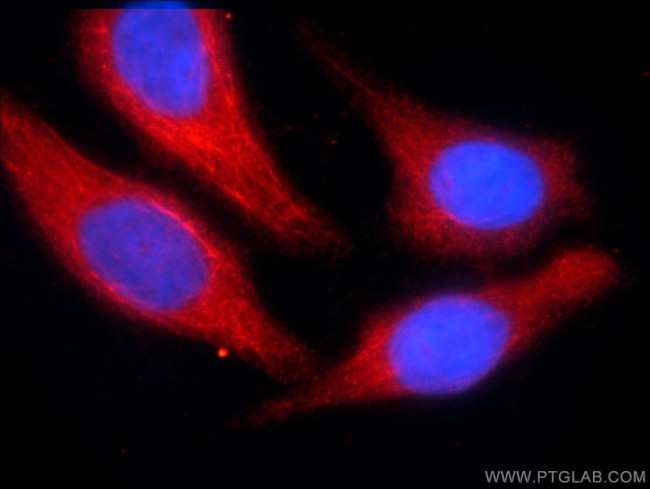 C3orf43 Antibody in Immunocytochemistry (ICC/IF)
