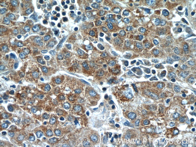 TMEM182 Antibody in Immunohistochemistry (Paraffin) (IHC (P))