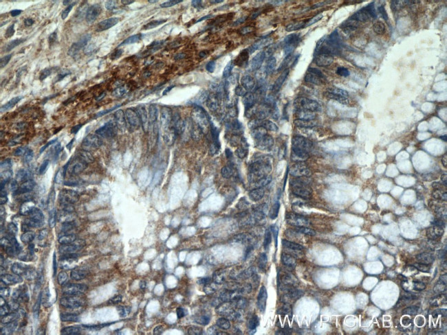 HIGD1B Antibody in Immunohistochemistry (Paraffin) (IHC (P))
