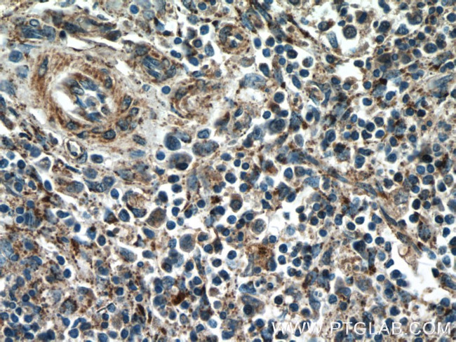 YOD1 Antibody in Immunohistochemistry (Paraffin) (IHC (P))