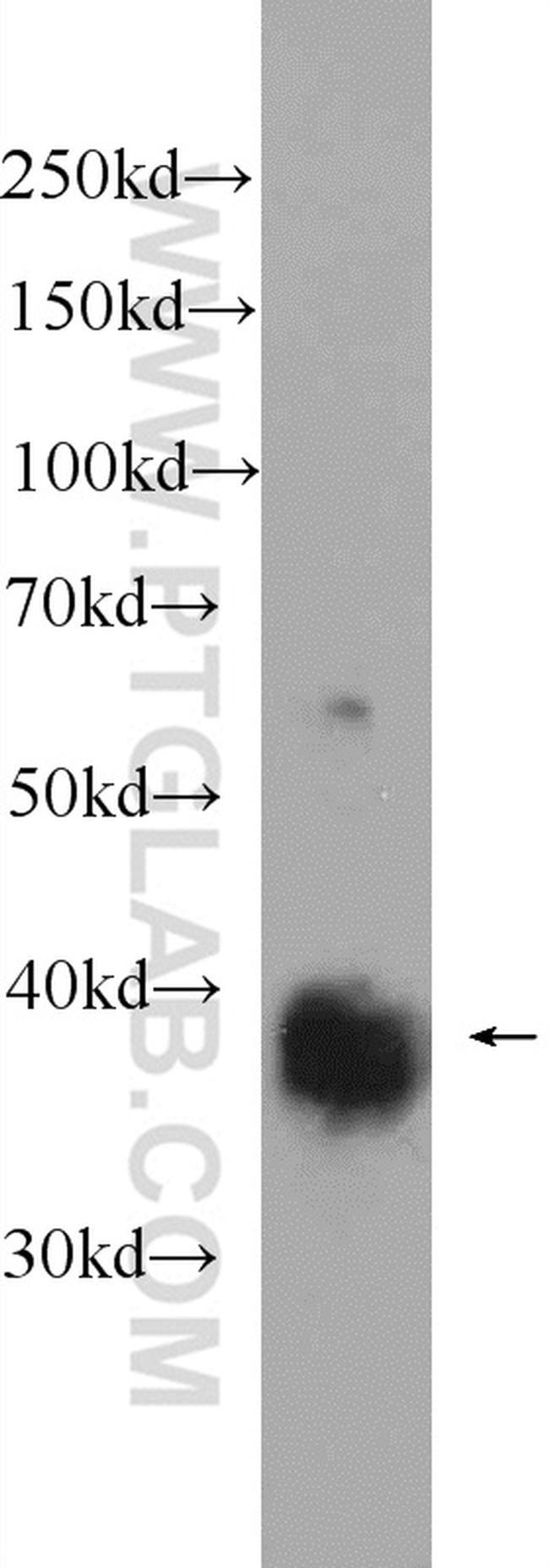REM2 Antibody in Western Blot (WB)