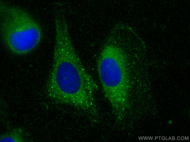TMTC4 Antibody in Immunocytochemistry (ICC/IF)