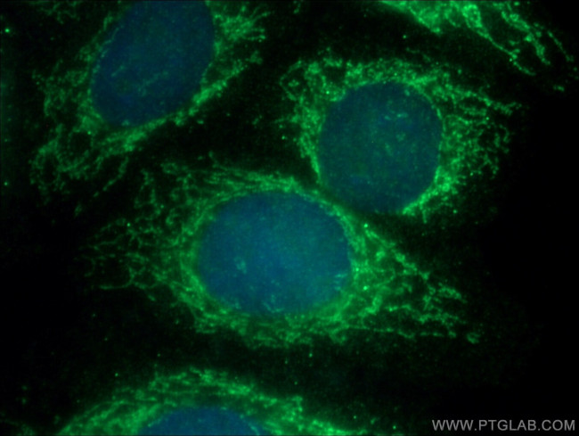 TRNT1 Antibody in Immunocytochemistry (ICC/IF)