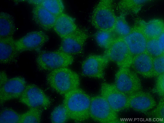 TMEM200A Antibody in Immunocytochemistry (ICC/IF)