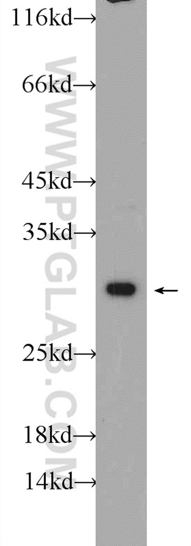 NUP62CL Antibody in Western Blot (WB)