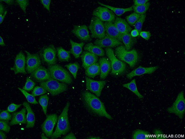 FAM160B1 Antibody in Immunocytochemistry (ICC/IF)