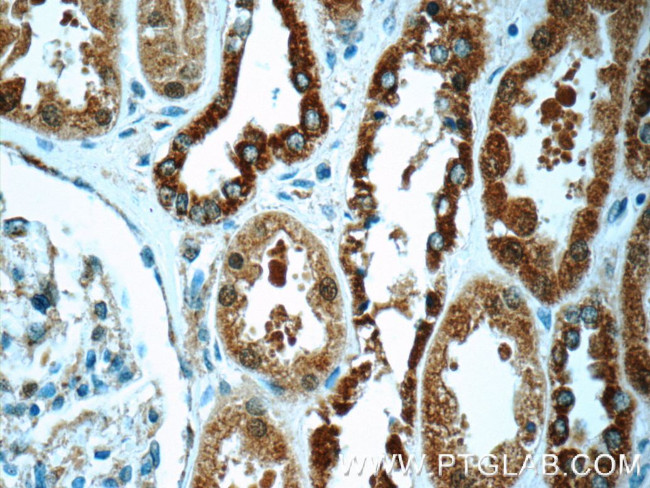 FAM20C Antibody in Immunohistochemistry (Paraffin) (IHC (P))