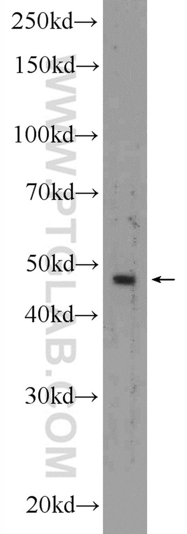 KRT40 Antibody in Western Blot (WB)
