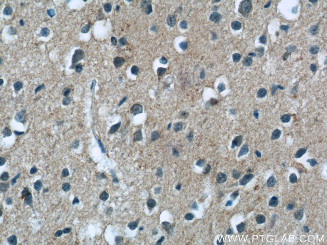 MGC39372 Antibody in Immunohistochemistry (Paraffin) (IHC (P))