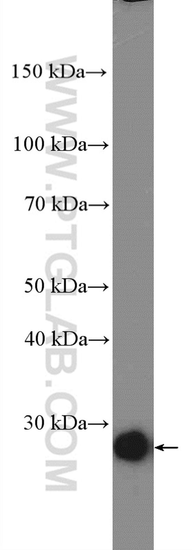 C13orf27/TEX30 Antibody in Western Blot (WB)