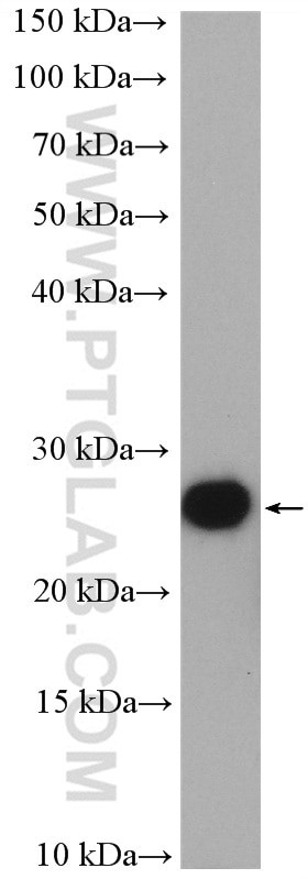 TTDN1 Antibody in Western Blot (WB)