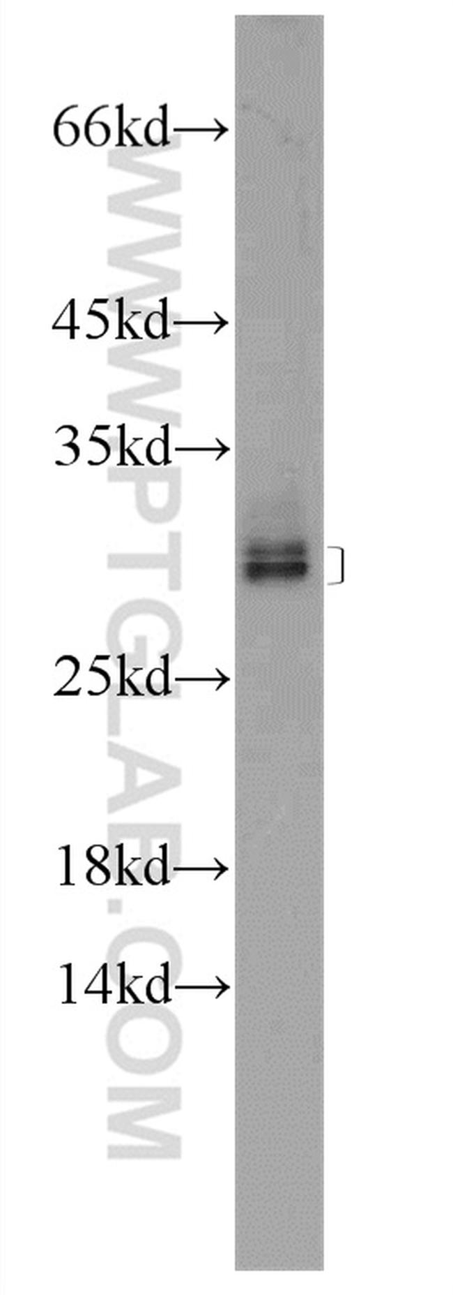 ZNF740 Antibody in Western Blot (WB)
