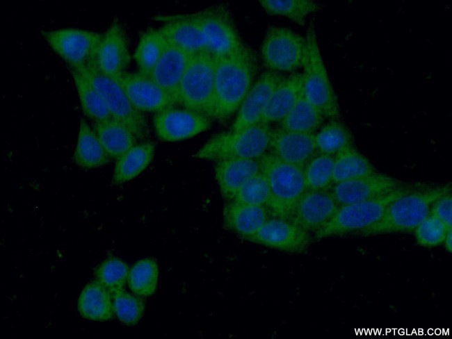 G6PD Antibody in Immunocytochemistry (ICC/IF)