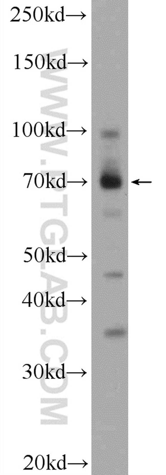 ZBTB44 Antibody in Western Blot (WB)