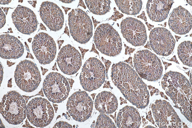 TTC32 Antibody in Immunohistochemistry (Paraffin) (IHC (P))