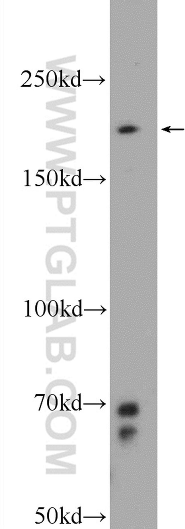 PPRC1 Antibody in Western Blot (WB)