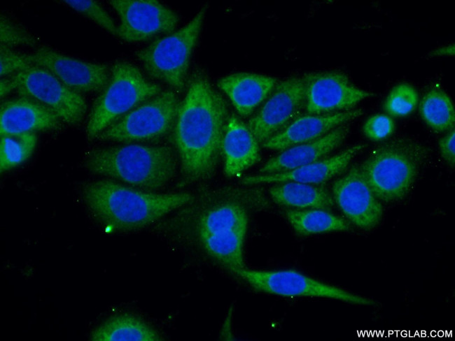 OTUD6B Antibody in Immunocytochemistry (ICC/IF)
