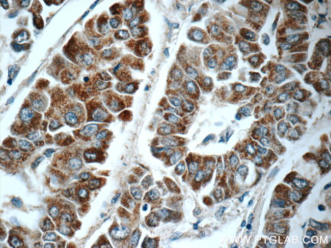 C1orf56 Antibody in Immunohistochemistry (Paraffin) (IHC (P))