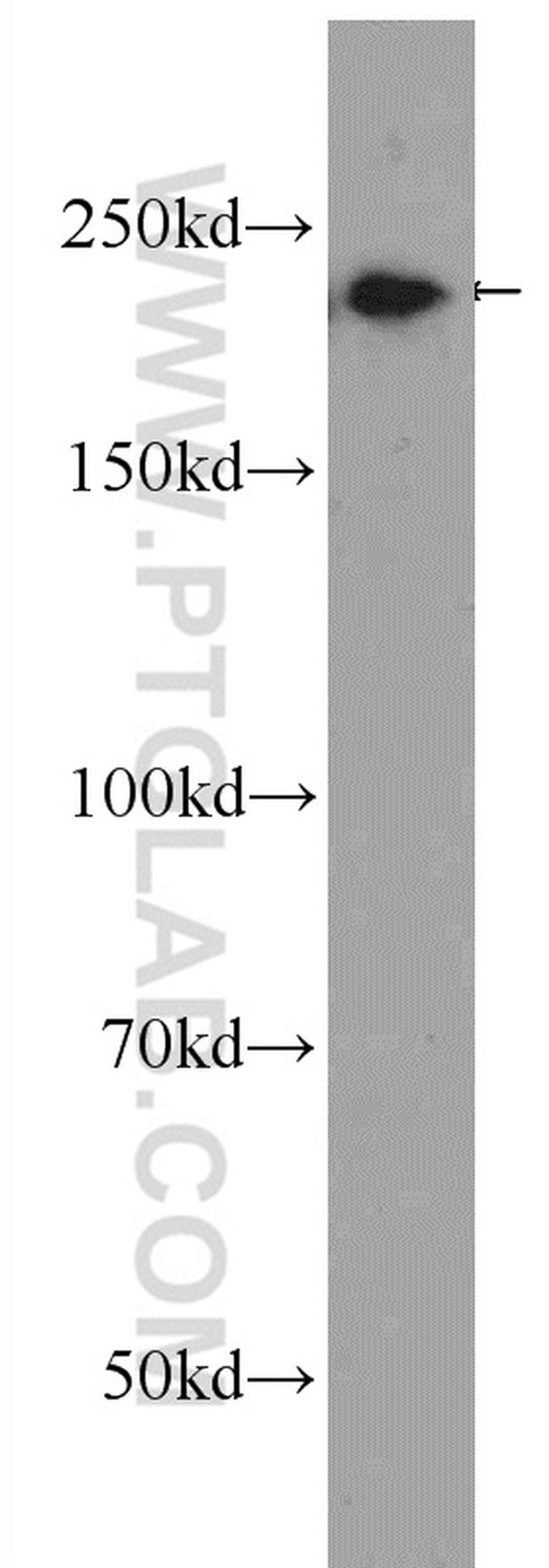 Envoplakin Antibody in Western Blot (WB)
