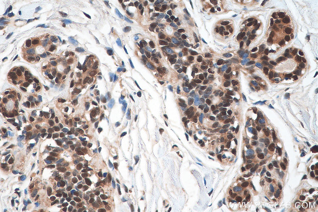 DNAJC9 Antibody in Immunohistochemistry (Paraffin) (IHC (P))