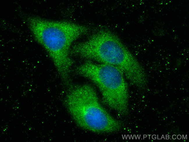 DCLK2 Antibody in Immunocytochemistry (ICC/IF)