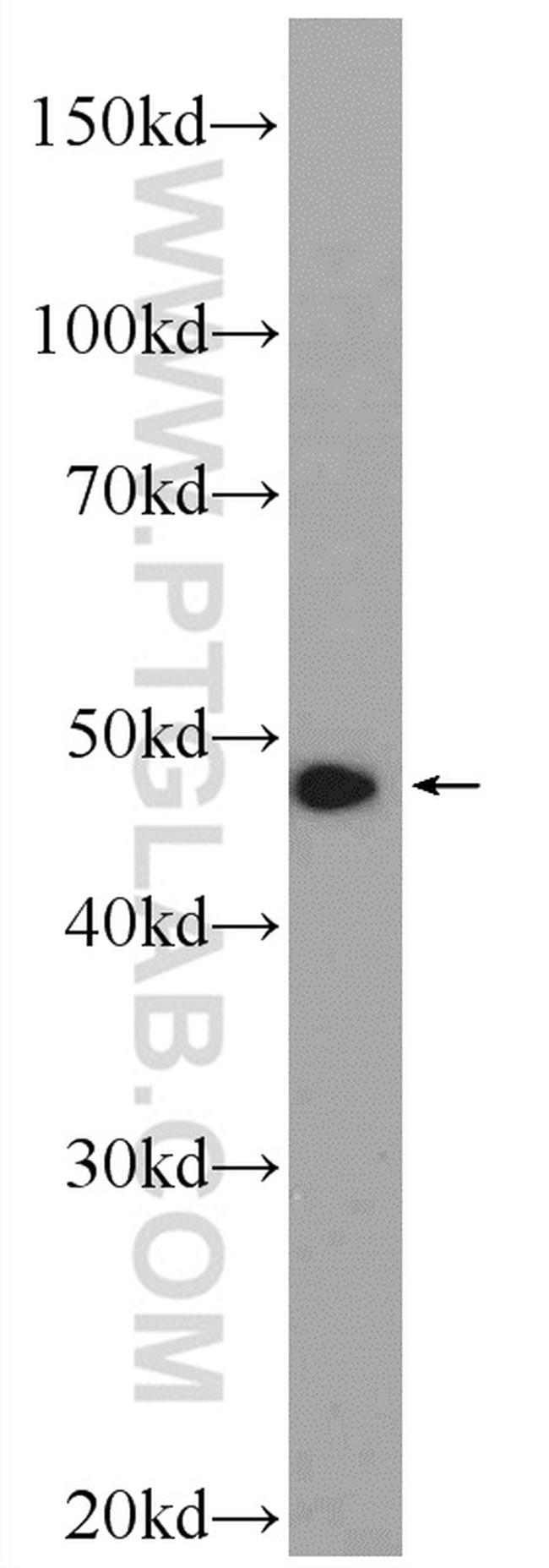 ZNF211 Antibody in Western Blot (WB)