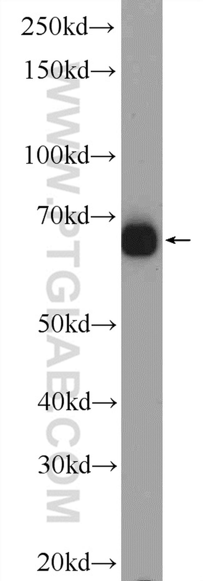 ZNF48 Antibody in Western Blot (WB)