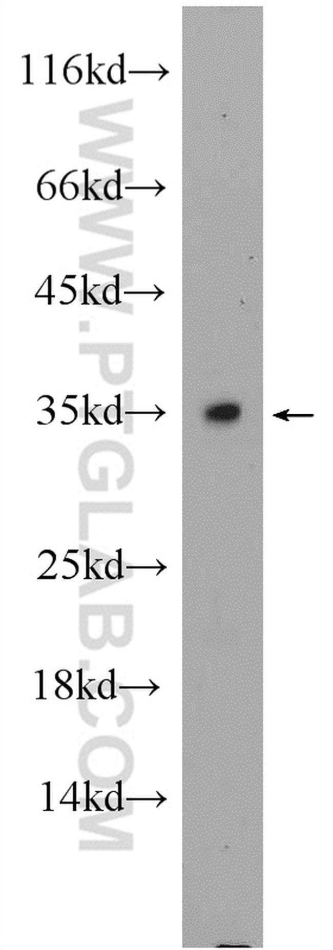 C2orf51 Antibody in Western Blot (WB)