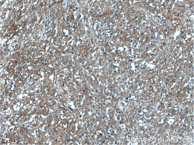 PNPLA4 Antibody in Immunohistochemistry (Paraffin) (IHC (P))