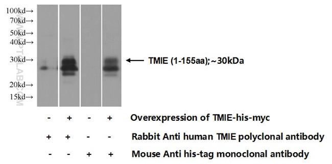 TMIE Antibody in Western Blot (WB)