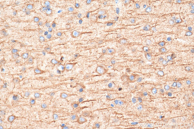 PTPRT Antibody in Immunohistochemistry (Paraffin) (IHC (P))