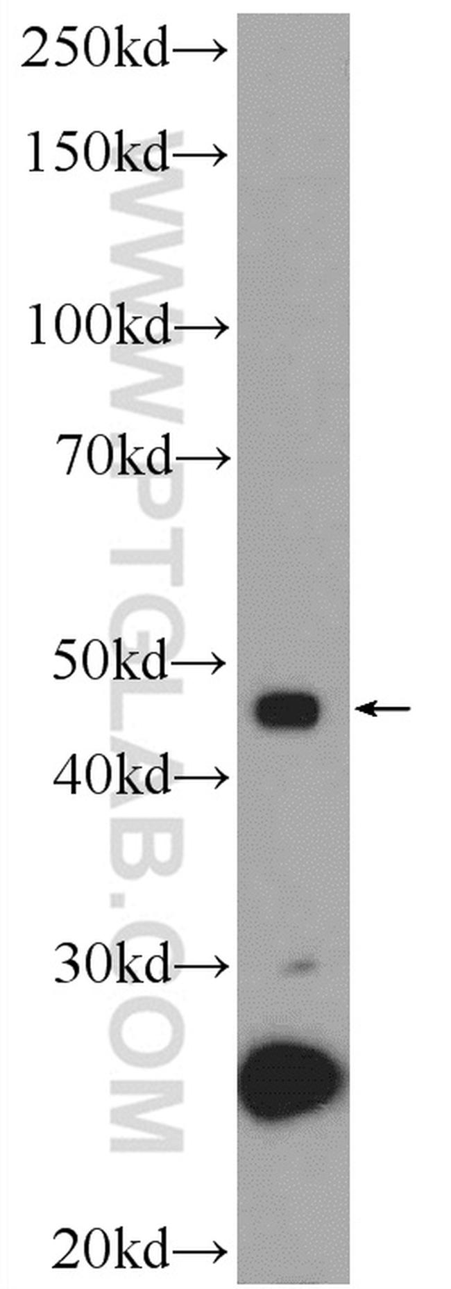 ZNF506 Antibody in Western Blot (WB)
