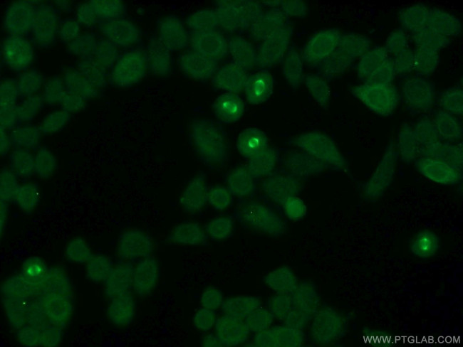 CKAP2 Antibody in Immunocytochemistry (ICC/IF)